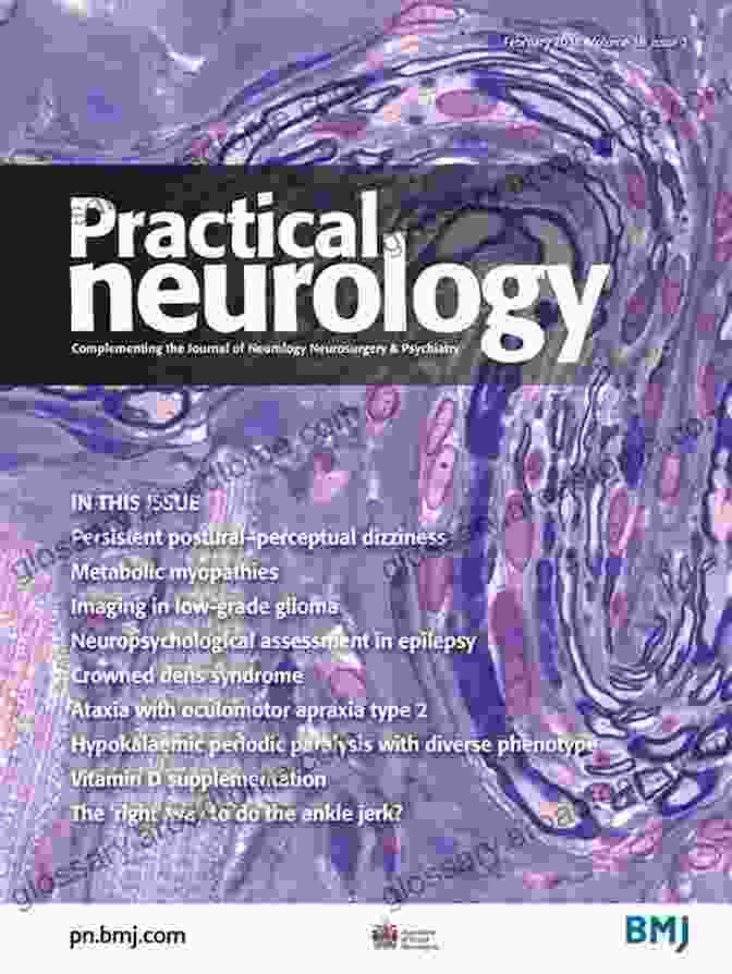 Persistent Postural Perceptual Dizziness PPP Journal Cover PERSISTENT POSTURAL PERCEPTUAL DIZZINESS (PPPD) JOURNAL: Persistent Postural Perceptual Dizziness (PPPD) Journal Management Workbook With Diagnosis Pain Treatment Fatigue Therapies Anxi