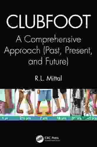 Clubfoot: A Comprehensive Approach (Past Present And Future)