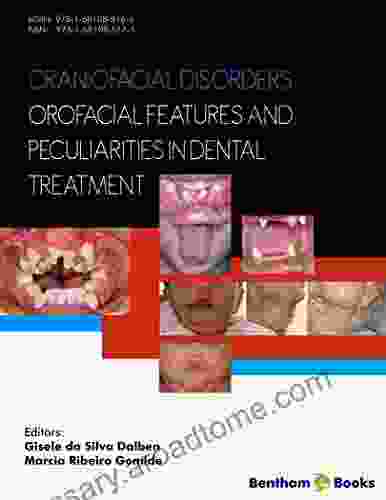 Craniofacial Disorders Orofacial Features And Peculiarities In Dental Treatment