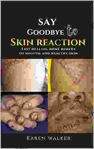 SAY GOOD BYE TO SKIN REACTIONS: Fast Healing Home Remedy To Smooth And Healthy Skin