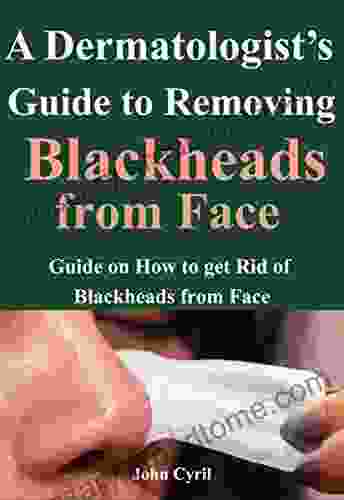 a dermatologist guide to removing black heads from face: guide on how to get rid of blackheads from face